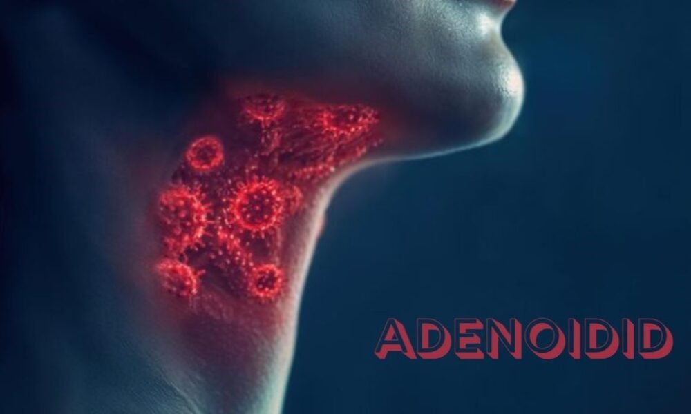 Adenoidid
